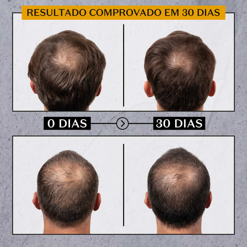 O Boticario Anti Hair Loss Shampoo - 250ml